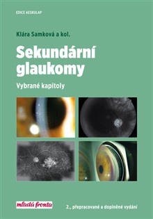 Sekundární glaukomy - 2.vydání