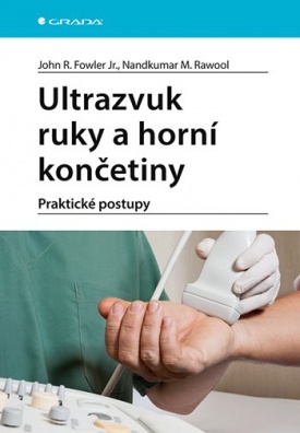 Ultrazvuk ruky a horní končetiny. Praktické postupy
