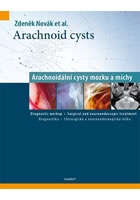 Arachnoid cysts - Arachnoidální cysty mozku a míchy