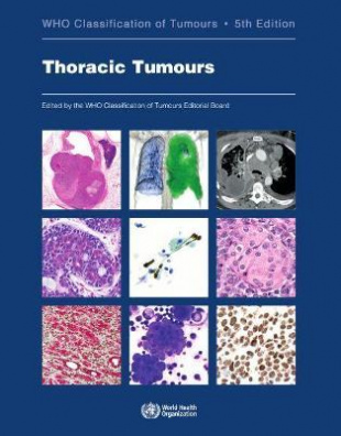 WHO Classification of Thoracic Tumours 5th ed., 2021