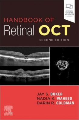 Handbook of Retinal OCT: Optical Coherence Tomography 2nd edition