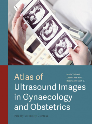 Atlas of Ultrasound Images in Gynaecology and Obstetrics