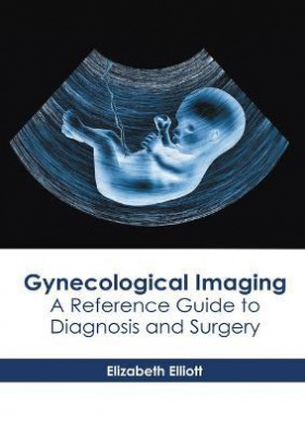 Gynecological Imaging: A Reference Guide to Diagnosis and Surgery