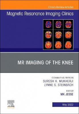 MR Imaging of The Knee, An Issue of Magnetic Resonance Imaging Clinics of North America: Volume 30-2