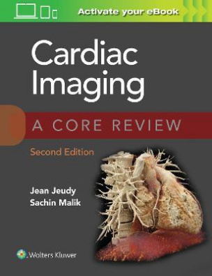 Cardiac Imaging: A Core Review  2nd edition
