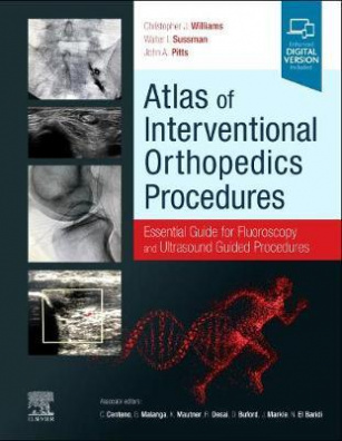 Atlas of Interventional Orthopedics Procedures : Essential Guide for Fluoroscopy and Ultrasound Guid