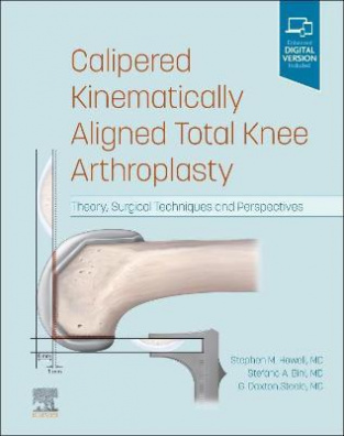 Calipered Kinematically aligned Total Knee Arthroplasty : Theory, Surgical Techniques and Perspectiv