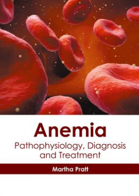 Anemia: Pathophysiology, Diagnosis and Treatment