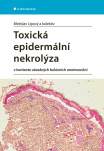 Toxická epidermální nekrolýza, v kontextu závažných bulózních onemocnění