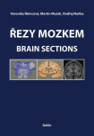 Řezy mozkem / Brain Sections