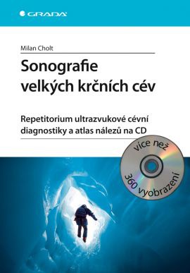 Sonografie velkých krčních cév - Repetitorium ultrazvukové cévní diagnostiky a atlas nálezů na CD