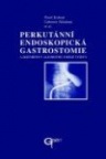 Perkutánní endoskopická gastrostomie a její místo v algoritmu umělé výživy