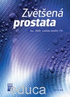 Zvětšená prostata
