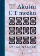 Akutní CT mozku. Atlas nálezů