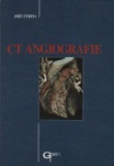 CT angiografie