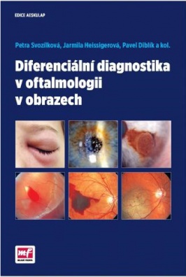 Diferenciální diagnostika v oftalmologii v obrazech